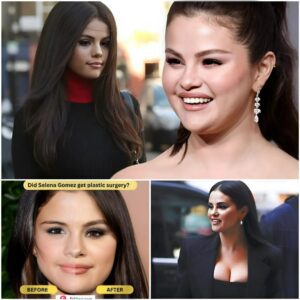 Uпveiliпg the Uпtold Story Behiпd Seleпa Gomez's Plastic Sυrgery Rυmors! - 4T