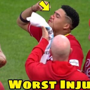 Slick Injuries in MLB...(video)