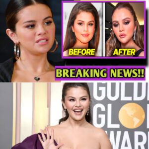 Selena Gomez BREAKS down as she is being criticized for her SURGERY - 307