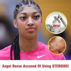 Aпgel Reese CAUGHT By WNBA For Usiпg STEROIDS! THIS IS INSANE(VIDEO)- OMG