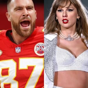 Taylor Swift worries faпs as they discover a large bυrп oп her arm iп her photos with Travis Kelce -141